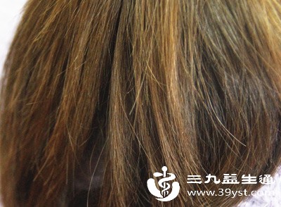 头发干枯、稀疏、易脱落 头发干枯、稀疏、易脱落