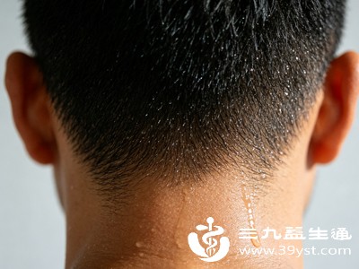 男人后脑勺总出汗 别当成怕热 其实是身体在悄悄预警