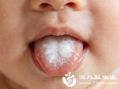 舌头出现白苔+裂纹 原因藏在这里 针对性调理轻松摆脱困扰