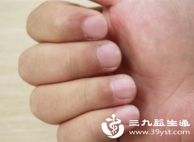 指甲上有小坑是怎么回事 指甲是健康窗口 看懂身体隐性问题