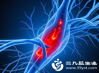 比如天气炎热时,身体血管会扩张,组织液分泌增多,走路久了更容易出现手肿 比如天气炎热时,身体血管会扩张,组织液分泌增多,走路久了更容易出现手肿