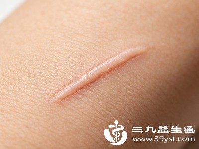 疤痕体质有疤别乱治 3个方法让疤痕悄悄“隐形” 亲测有效