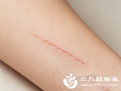 疤痕修复的黄金期是伤口愈合后的3-6个月,此时疤痕组织还未完全稳定,及时干预能有效抑制增生 疤痕修复的黄金期是伤口愈合后的3-6个月,此时疤痕组织还未完全稳定,及时干预能有效抑制增生
