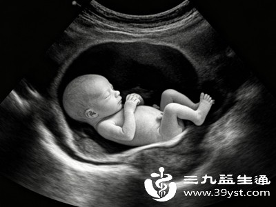 胎儿缺氧多与母体作息、体态、气血状态相关，日常养生安胎可有效规避风险