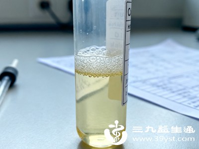 不用瞎猜 尿亚硝酸盐阳性原因和应对方法都在这