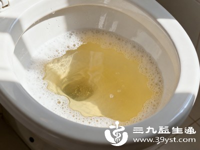 采集尿液时没有做好清洁,导致外界细菌混入尿液 采集尿液时没有做好清洁,导致外界细菌混入尿液