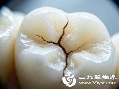 牙齿有裂纹能自愈吗 牙医实话 分情况别傻傻硬扛