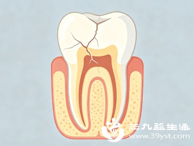 牙齿裂纹分轻重等级，不同裂纹的危害和处理方式完全不同，对症处理才能保护牙齿