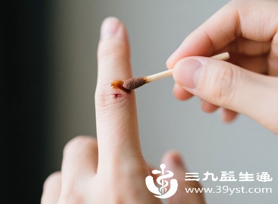 感染若不及时处理,可能扩散至全身,引发更严重的健康问题 感染若不及时处理,可能扩散至全身,引发更严重的健康问题