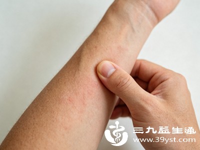 皮肤干燥、瘙痒:全身皮肤状态变差 皮肤干燥、瘙痒:全身皮肤状态变差