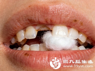 拔牙后若持续出血，首先要做的就是咬纱布止血。取干净无菌纱布或棉花，折叠成合适大小，轻轻放在出血创口上，用力咬住，保持30-60分钟