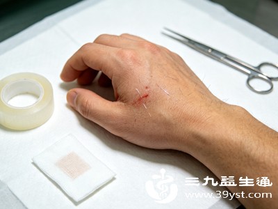 日常尽量保持手部干爽透气，不要立刻沾水、触碰灰尘杂物，给皮肤修复的时间，快速消退泛红、灼热、瘙痒症状