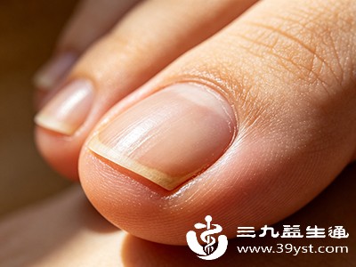 发现脚趾甲长横纹？别瞎猜！可能是这几种情况 看完心里有谱了