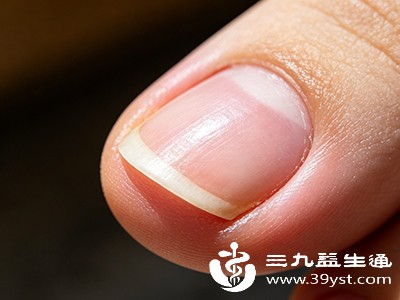 真菌感染(甲癣)是指甲异常常见原因 真菌感染(甲癣)是指甲异常常见原因