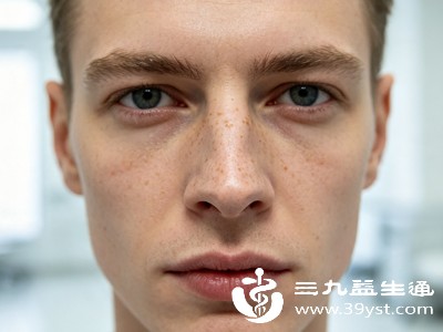 鼻梁是面部最高凸起部位,常年直面阳光照射,不做好防晒,紫外线会直接刺激肌肤黑色素沉淀,加重原有斑点,或诱发新生色斑 鼻梁是面部最高凸起部位,常年直面阳光照射,不做好防晒,紫外线会直接刺激肌肤黑色素沉淀,加重原有斑点,或诱发新生色斑
