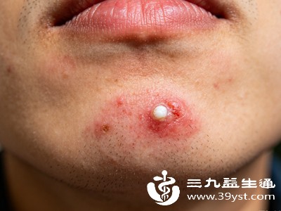 外在体态和肤质也会受影响,表现为皮肤油腻爆痘、头发出油脱发、面色暗沉无光,整个人气色变差、衰老加速,单纯依靠进补、休息很难改善,根源在于代谢节律紊乱 外在体态和肤质也会受影响,表现为皮肤油腻爆痘、头发出油脱发、面色暗沉无光,整个人气色变差、衰老加速,单纯依靠进补、休息很难改善,根源在于代谢节律紊乱