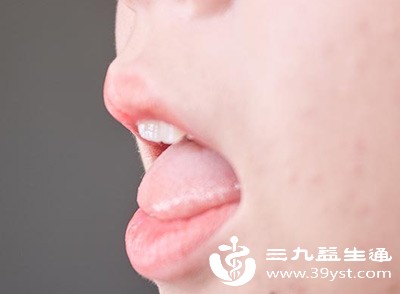 唇舌血管密集、感知灵敏，是心脑血管问题的首发预警部位