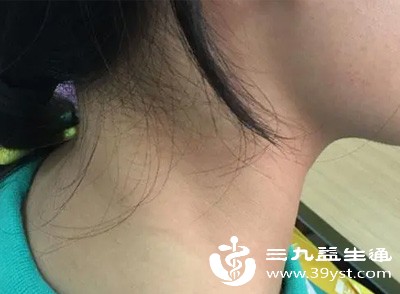 脖子粗双下巴明显 饮食+运动+姿势 三管齐下帮你改善