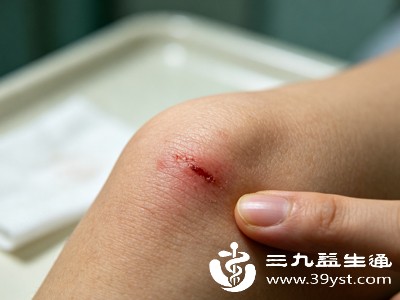 伤口长期潮湿、清洁不到位,是诱发瘙痒、加重不适的重要原因 伤口长期潮湿、清洁不到位,是诱发瘙痒、加重不适的重要原因