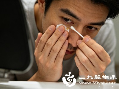 眼屎到底是怎么来的 少量是代谢 出现这几种情况快就医