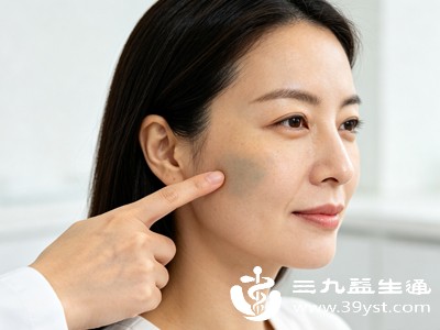 真皮斑多为点状、小片状，颜色偏青褐色、深棕黑色，斑点边界清晰独立，一颗颗分布在颧骨、眼周，不会大面积晕开，颜色比黄褐斑更深、更暗沉