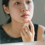 皮肤暗沉做好防晒+保湿