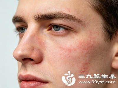 当环境湿度低于40%时,皮肤水分流失量会大幅增加,若未及时补充保湿,就会出现干燥起皮 当环境湿度低于40%时,皮肤水分流失量会大幅增加,若未及时补充保湿,就会出现干燥起皮