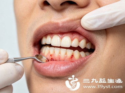 阴虚火旺体质，长期劳累、作息紊乱会耗伤身体阴液，导致虚火上浮，牙龈失去津液滋养，变得干燥脆弱，极易出血
