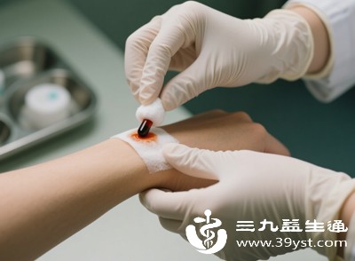 感染是伤口愈合的“绊脚石”