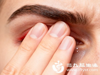 长期不注意眼部清洁,如不及时卸妆、用脏手揉眼、佩戴隐形眼镜前未彻底洗手等,会导致眼部细菌滋生,增加眼疖子的发病风险 长期不注意眼部清洁,如不及时卸妆、用脏手揉眼、佩戴隐形眼镜前未彻底洗手等,会导致眼部细菌滋生,增加眼疖子的发病风险