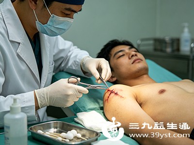 伤口愈合关键在拆线 晚拆的影响全知道