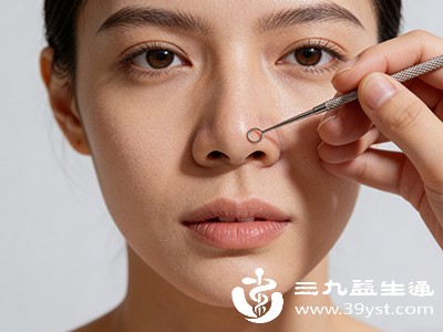 即使使用粉刺针,也需在专业指导下操作,避免过度用力 即使使用粉刺针,也需在专业指导下操作,避免过度用力