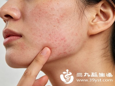 若通过自我观察无法明确过敏原,或过敏症状反复发作、较为严重,可到医院进行专业检查 若通过自我观察无法明确过敏原,或过敏症状反复发作、较为严重,可到医院进行专业检查