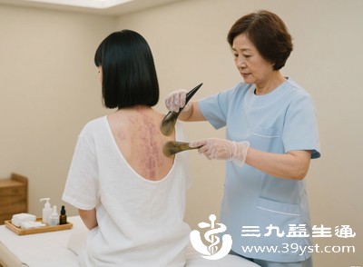 刮痧产生的机械刺激能促进局部血液循环,改善组织代谢 刮痧产生的机械刺激能促进局部血液循环,改善组织代谢
