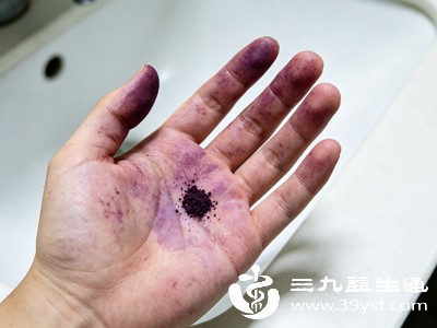高锰酸钾弄到手上怎么洗掉不用死搓 居家妙招快速去黑印