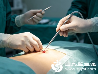 传统抽脂操作口径大、抽吸力度集中，对皮下组织、毛细血管损伤相对明显，术中出血量稍多，术后肿胀、淤青更严重，恢复周期更长，需要长时间穿戴塑身衣固定塑形