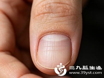 指甲的生长需要充足的营养物质,若长期缺乏蛋白质、维生素A、B族维生素以及钙、铁、锌等微量元素,会影响指甲的正常角化过程,导致甲板出现凹凸不平、失去光泽等问题 指甲的生长需要充足的营养物质,若长期缺乏蛋白质、维生素A、B族维生素以及钙、铁、锌等微量元素,会影响指甲的正常角化过程,导致甲板出现凹凸不平、失去光泽等问题