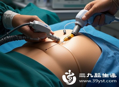 腹部皮下遍布细密的毛细血管和末梢神经，掌控着腹部的感知与气血循环