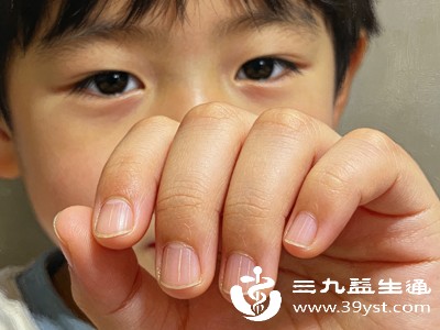 从原因到护理 小孩指甲白点的全面科普 让家长不再焦虑