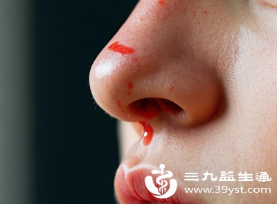 患者可能出现皮肤瘀斑、牙龈出血、鼻出血等症状
