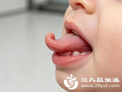 观察宝宝舌头能否灵活舔到上颚前部或下唇内侧，若活动范围受限，也需警惕