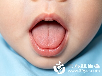 舌系带短可能导致宝宝舌头无法充分清洁口腔内侧及牙龈，增加口腔黏膜炎症风险
