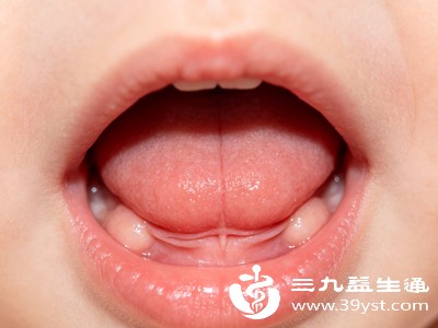 对于月龄较小、无明显功能影响的宝宝，可暂时观察，多数宝宝的舌系带会随颌骨发育逐渐变长、变薄，功能恢复正常