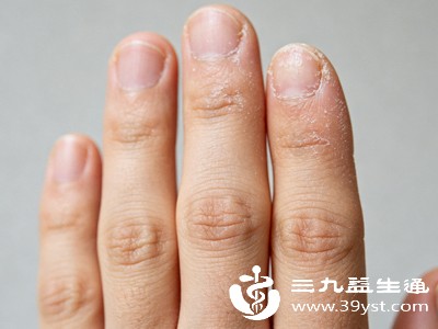 手癣、汗疱疹、剥脱性角质松解症等皮肤疾病也是手蜕皮的常见原因