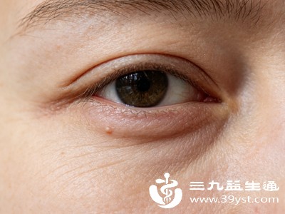如果父母一方或双方为杂合子双眼皮(Aa),情况就会有所不同 如果父母一方或双方为杂合子双眼皮(Aa),情况就会有所不同