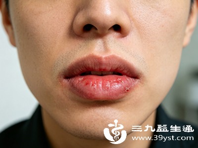厚嘴唇男生提升颜值指南 安全有效的唇部变薄方法大分享