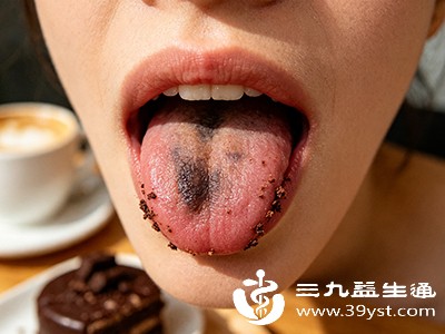 对于疑似食物、药物或创伤引起的黑点,可先观察1-2周,记录其大小、颜色、形态变化 对于疑似食物、药物或创伤引起的黑点,可先观察1-2周,记录其大小、颜色、形态变化