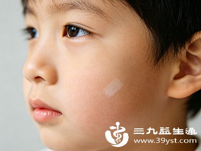 虽然多数白块为良性,但出现以下情况时需及时带宝宝就医 虽然多数白块为良性,但出现以下情况时需及时带宝宝就医