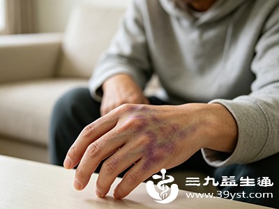 若颜色持续加深、范围扩大，需立即就医