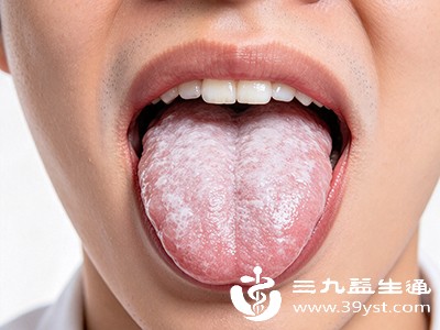 舌苔厚白的症状仍未改善,或反而加重,可能提示存在潜在的脏腑功能问题 舌苔厚白的症状仍未改善,或反而加重,可能提示存在潜在的脏腑功能问题
